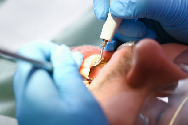 Best Emergency Dental Surgery in Underwood Petersville, AL