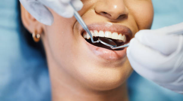 Best Emergency Tooth Extraction in Underwood Petersville, AL