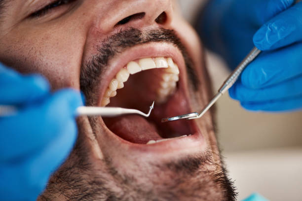 Best After-Hours Emergency Dentist in Underwood Petersville, AL